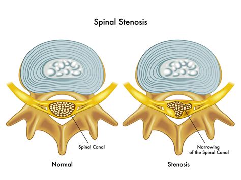backendlinescenter|What Does a Back.